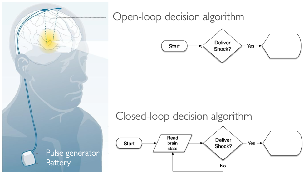 Closed-loop DBS system would read out the patient’s brain state to modulate stimulation intensity accordingly based on if the patient is awake, stationary, or moving